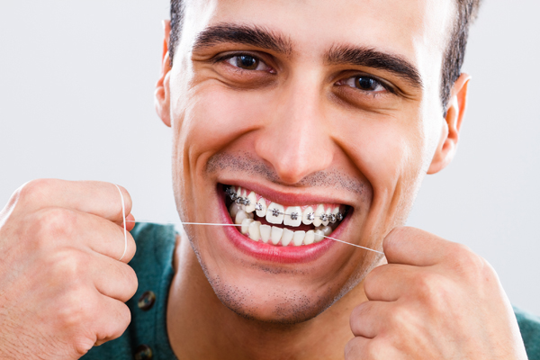 How To Get The Best Outcome When It Comes To Braces In Mountain View Ca
